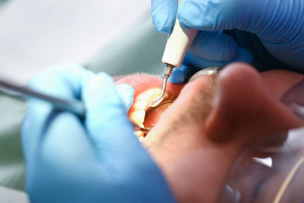 Best Emergency Treatment for Jaw Pain or Injury in Mount Carroll, IL