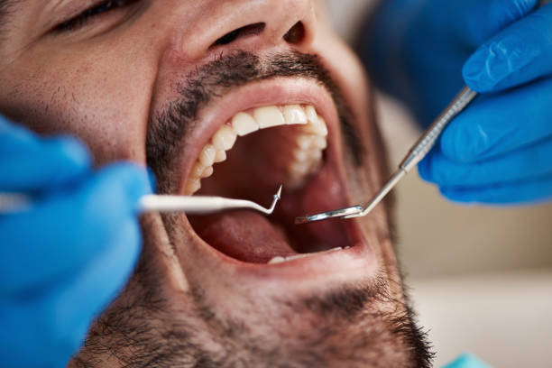 Best Broken or Chipped Tooth Repair in Mount Carroll, IL
